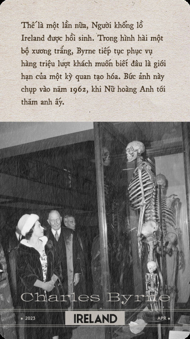 Bộ xương Người khổng lồ Ireland: Tấn bi kịch gây tranh cãi nhất lịch sử Anh Quốc - Ảnh 15.