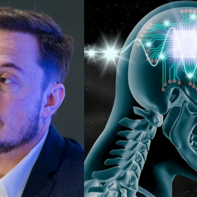 Công ty của Elon Musk chuẩn bị cấy ghép chip vào não người để "chế tạo" siêu nhân
