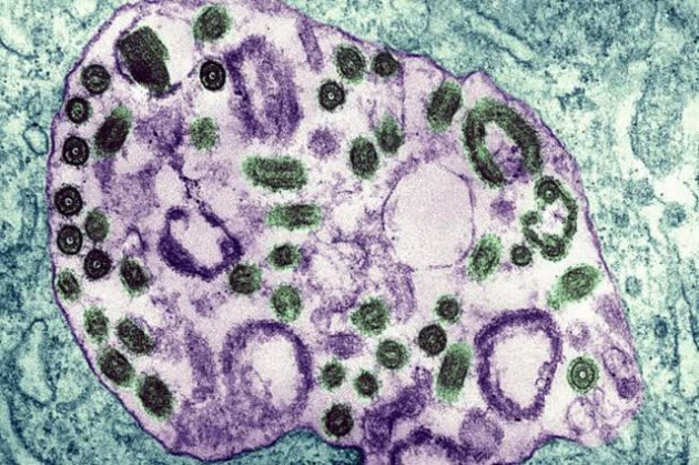  Đã có 9 người chết liên quan đến virus Marburg: Các chuyên gia nói gì về dịch bệnh với tỷ lệ tử vong lên tới 88%? - Ảnh 3.