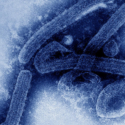 Một loại virus chết người mới giống Ebola vừa bùng phát: Không có phương pháp điều trị cũng không có vắc-xin