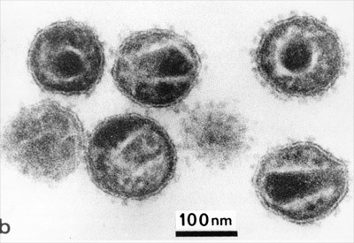 Những sự thật ít người biết về virus: Chúng đến từ đâu, lây lan và gây bệnh như thế nào?