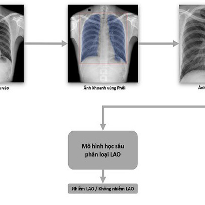 VinBrain và FIT phát hành sách trắng về ứng dụng trí tuệ nhân tạo cho chẩn đoán và tầm soát bệnh lao