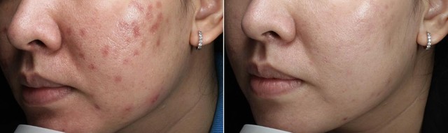 DRH Clinic, phòng khám da liễu Top 10 Thương Hiệu Uy Tín Quốc Gia - Ảnh 1