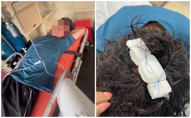 Sau cuộc điện thoại, shipper bị 2 vợ chồng đuổi đánh gây thương tích - Ảnh 2