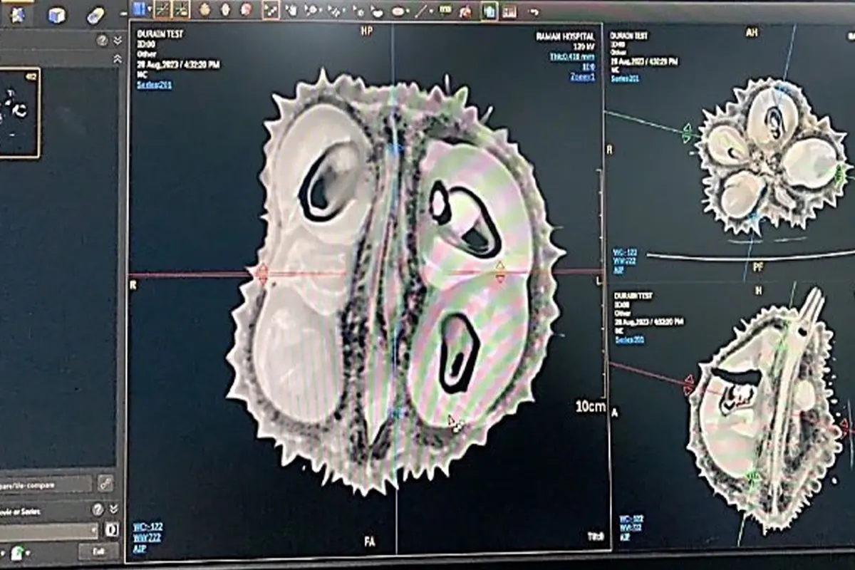 Bị Trung Quốc từ chối nhập khẩu, sợ Việt Nam truất ngôi: Thái Lan tung 'chiêu độc' dùng máy X-quang quét từng trái sầu riêng, độ chính xác 95%, công suất 1.200 quả/giờ - Ảnh 2
