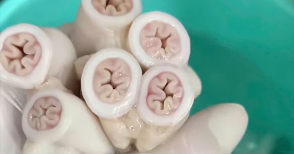 Vụ “lòng se điếu”: TP HCM đang lấy mẫu kiểm nghiệm