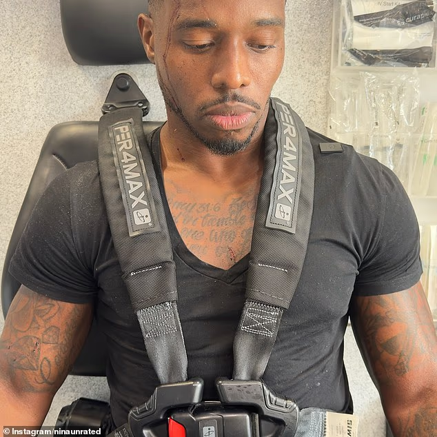 Đang quay mukbang trong nhà hàng sang trọng, cặp đôi nổi tiếng bất ngờ bị một chiếc SUV lao xuyên cửa đâm trúng - Ảnh 2