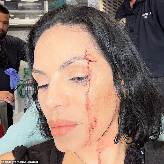 Đang quay mukbang trong nhà hàng sang trọng, cặp đôi nổi tiếng bất ngờ bị một chiếc SUV lao xuyên cửa đâm trúng - Ảnh 1