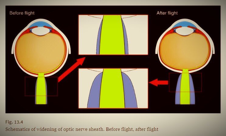 Trở về Trái đất sau chuyến du hành vũ trụ, đôi mắt của nhiều phi hành gia đã thay đổi - Ảnh 2