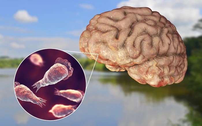 Phát hiện ‘amip ăn não’ trong nguồn nước sinh hoạt tại quốc gia có cộng đồng người Việt đông thứ 3 thế giới - Ảnh 1