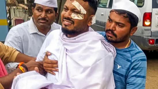 Tình hình hiện tại của người sống sót duy nhất trong thảm kịch máy bay Air India sau 3 tháng - Ảnh 2