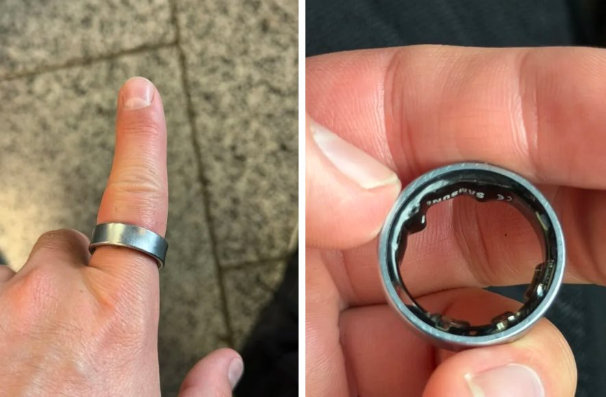 Người dùng hốt hoảng khi một sản phẩm của Samsung phồng pin, kẹt luôn trên ngón tay: "Vừa đau vừa sợ nổ" - Ảnh 1