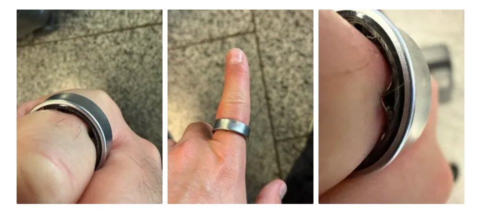 Người dùng hốt hoảng khi một sản phẩm của Samsung phồng pin, kẹt luôn trên ngón tay: "Vừa đau vừa sợ nổ" - Ảnh 2