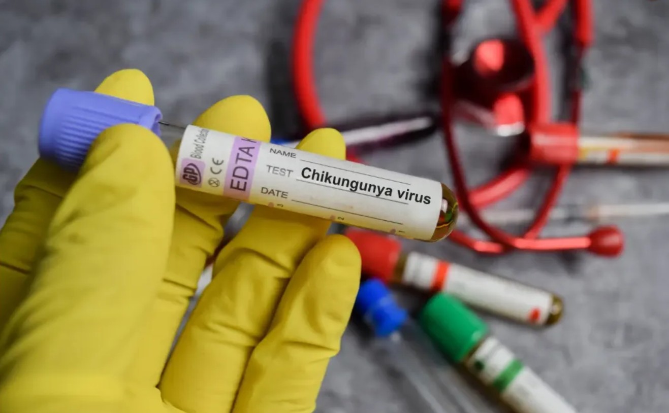 Loại virus khiến Trung Quốc phải kích hoạt kiểm soát dịch như thời Covid-19 đã xuất hiện ở quốc gia khác - Ảnh 2