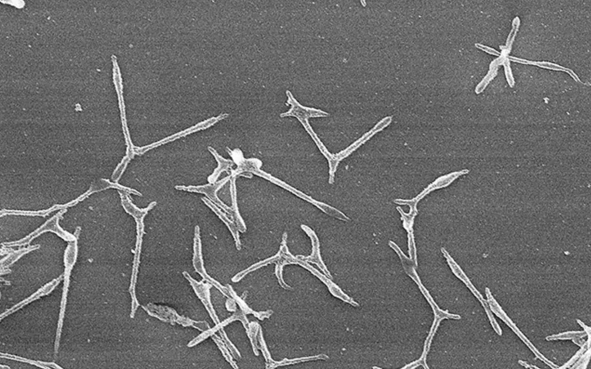 Gia tăng các ca viêm phổi do Mycoplasma, Nhật Bản cảnh báo nguy cơ bùng phát dịch - Ảnh 1