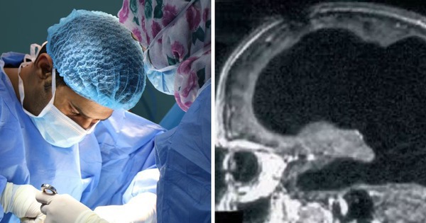 Bí ẩn về người đàn ông mất 90% não, nhưng vẫn có thể sống một cuộc sống bình thường