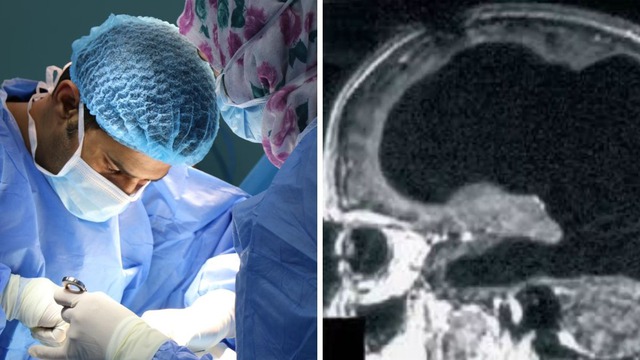 Bí ẩn về người đàn ông mất 90% não, nhưng vẫn có thể sống một cuộc sống bình thường - Ảnh 4