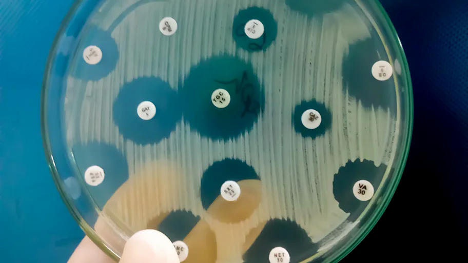 Một thứ bí ẩn bị "phong ấn" trong hang băng 5.000 năm vừa được giải phóng, có thể tạo ra phép màu cho nhân loại - Ảnh 2