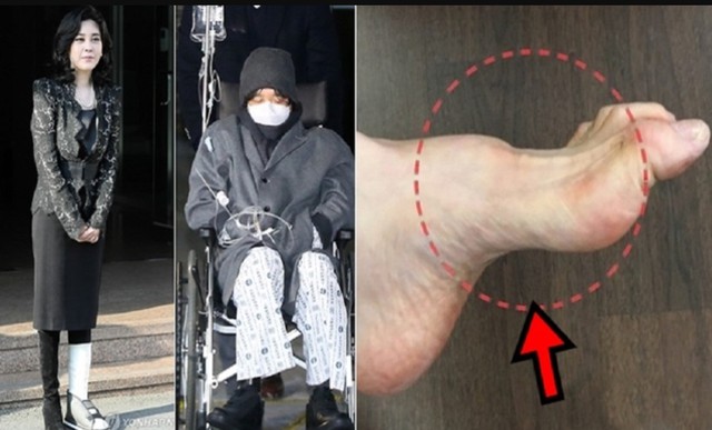 Gia tộc Samsung và căn bệnh di truyền đáng sợ mang tên teo cơ MÁC: Có tất cả nhưng cũng không thể chữa khỏi - Ảnh 5