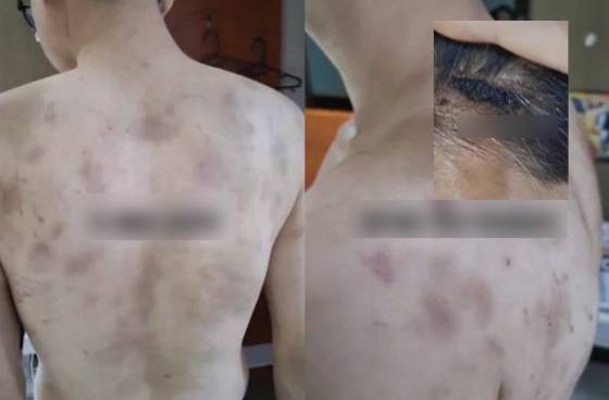 Rúng động Hàn Quốc: Nam nhân viên bị chủ quán hành hạ, ép làm việc 20 giờ/ngày, camera giám sát 24/7 - Ảnh 1