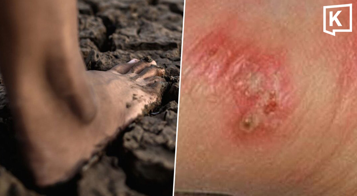 Thái Lan cảnh báo khẩn về dịch "sốt đất": 732 ca nhiễm, 23 trường hợp tử vong