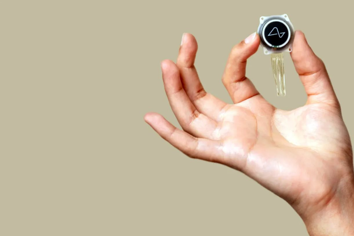 Elon Musk mắc sai lầm, liệu 300.000 bệnh nhân có vỡ mộng vì tin vào lời hứa của tỷ phú giàu nhất hành tinh? - Ảnh 3