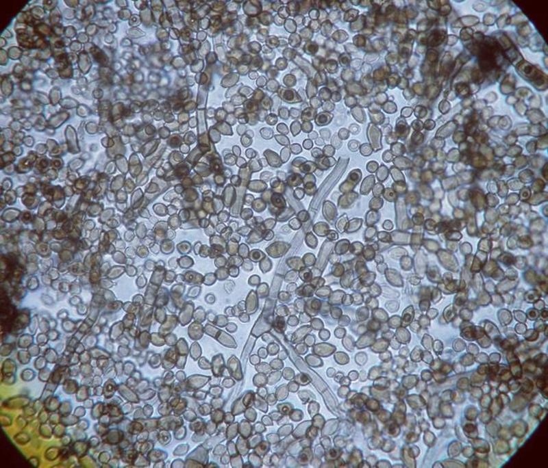 Một sinh vật đột biến đã được phát hiện ở Chernobyl, sở hữu những khả năng đặc biệt, bao gồm khả năng ăn bức xạ hạt nhân - Ảnh 4