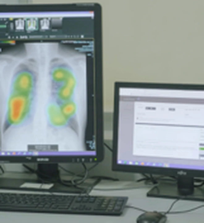 Chiến lược quản trị hình ảnh y tế số tập trung cho mô hình đa cơ sở - Ảnh 3