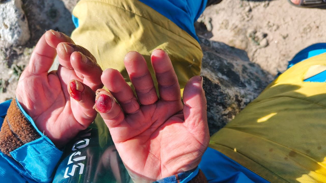 Kỳ tích trên Everest: Người đàn ông sống sót sau 7 ngày mất tích ở "vùng tử thần" - Ảnh 5