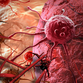 Sử dụng tảo nâu hỗ trợ hệ miễn dịch cho bệnh nhân ung thư